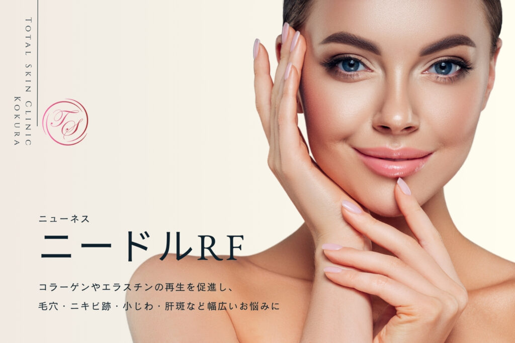 ニードルRF（ニューネス）｜小倉で毛穴・肝斑・ニキビ跡の治療なら