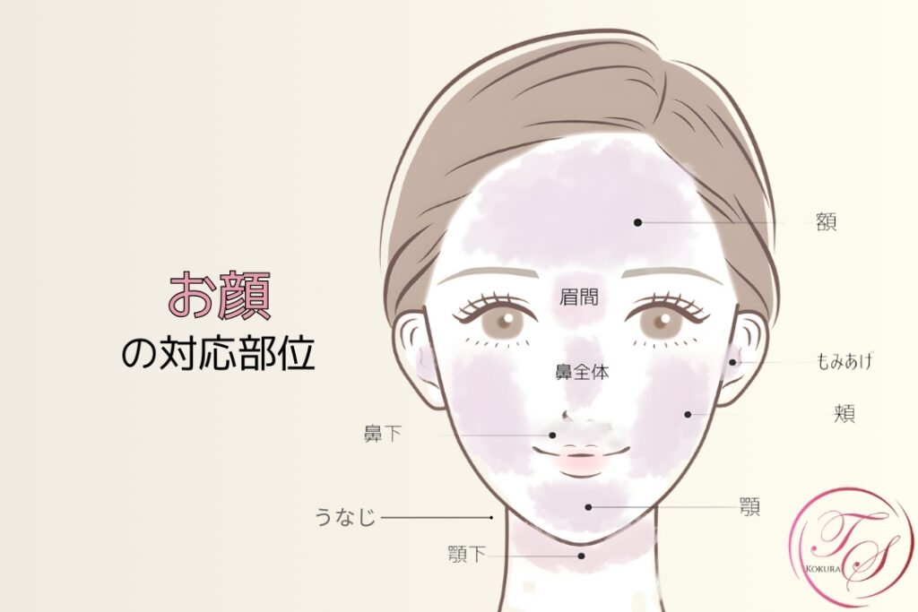 お顔の脱毛の対応部位: 額、眉間、鼻全体、鼻下、頬、あご、あご下、もみあげ 、うなじ-トータルスキンクリニック小倉院-