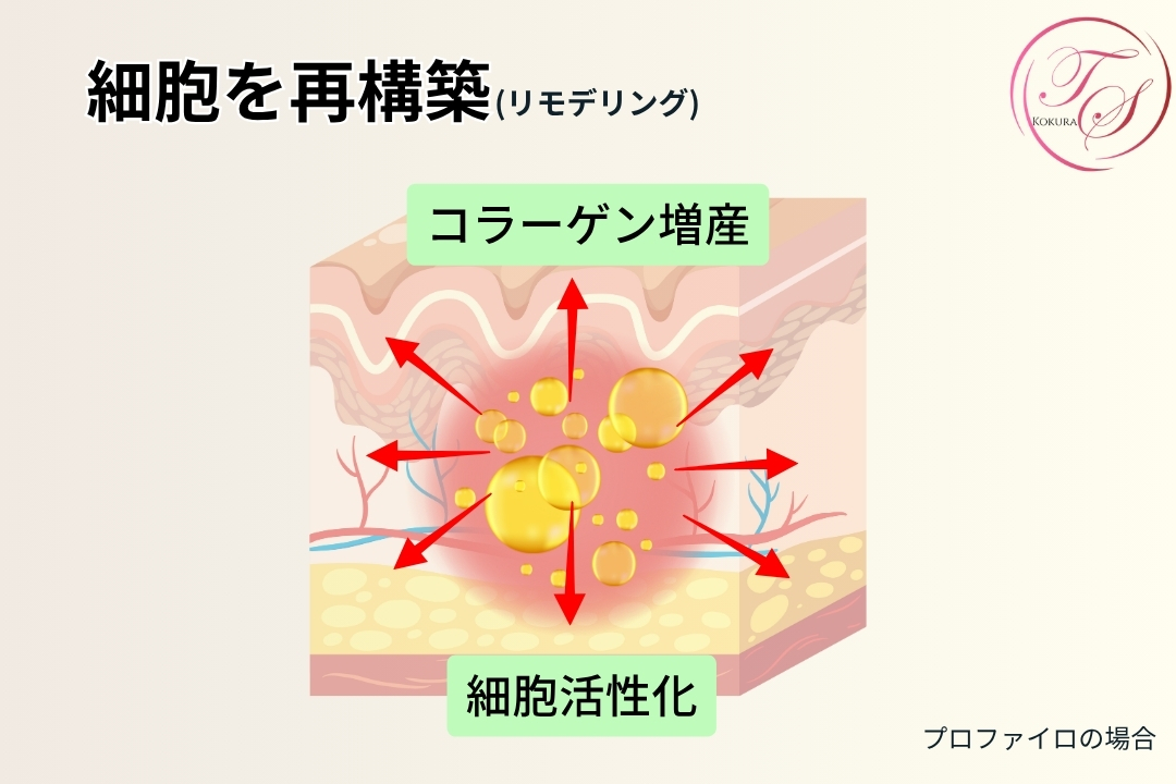 【プロファイロの場合】 細胞を再構築(リモデリング） コラーゲン増産 細胞活性化