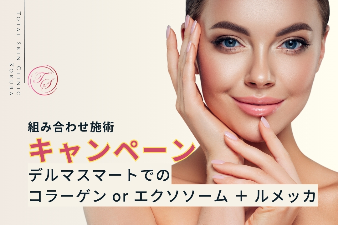 【期間限定キャンペーン】デルマスマートでのコラーゲン or エクソソーム ＋ ルメッカが同時施術でお得！