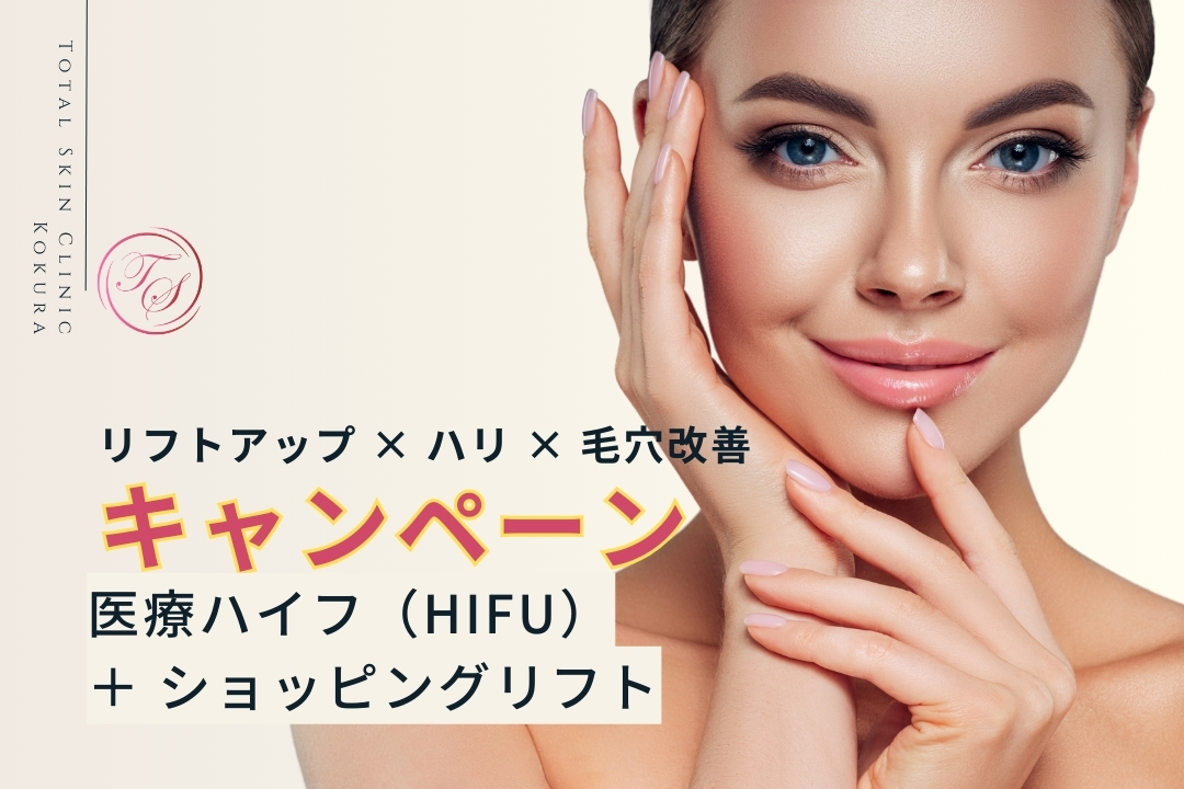 キャンペーン実施中ー「医療ハイフ（HIFU）＋ ショッピングリフト」〜リフトアップ × ハリ × 毛穴改善