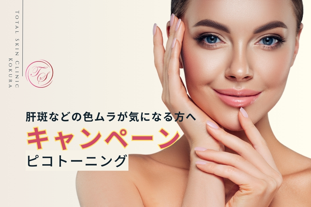 ピコトーニングキャンペーン実施中!肝斑などの色ムラが気になる方へ。トータルスキンクリニック小倉