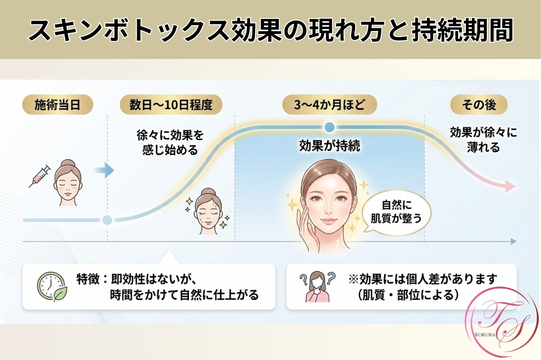 スキンボトックスの効果の現れ方と持続期間を説明する図解。施術当日から数日〜10日で効果が出始め、3〜4ヶ月間ピークが持続し、その後徐々に薄れていく経過を時系列のグラフとイラストで解説しています。