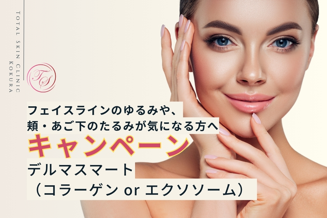 【デルマスマート（コラーゲン or エクソソームのキャンペーン実施中：トータルスキンクリニック小倉院】
フェイスラインのゆるみや、頬・あご下のたるみが気になる方へ