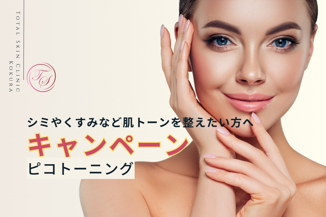 シミやくすみなど肌トーンを整えたい方へ！ピコトーニングのキャンペーン実施中（トータルスキンクリニック小倉院）