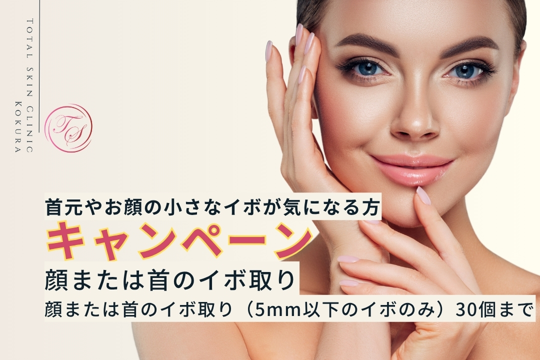 【キャンペーン実施中】顔または首のイボ取り(5mm以下・30個まで)キャンペーンのご案内。首元やお顔の小さなイボが気になる方(トータルスキンクリニック小倉院)