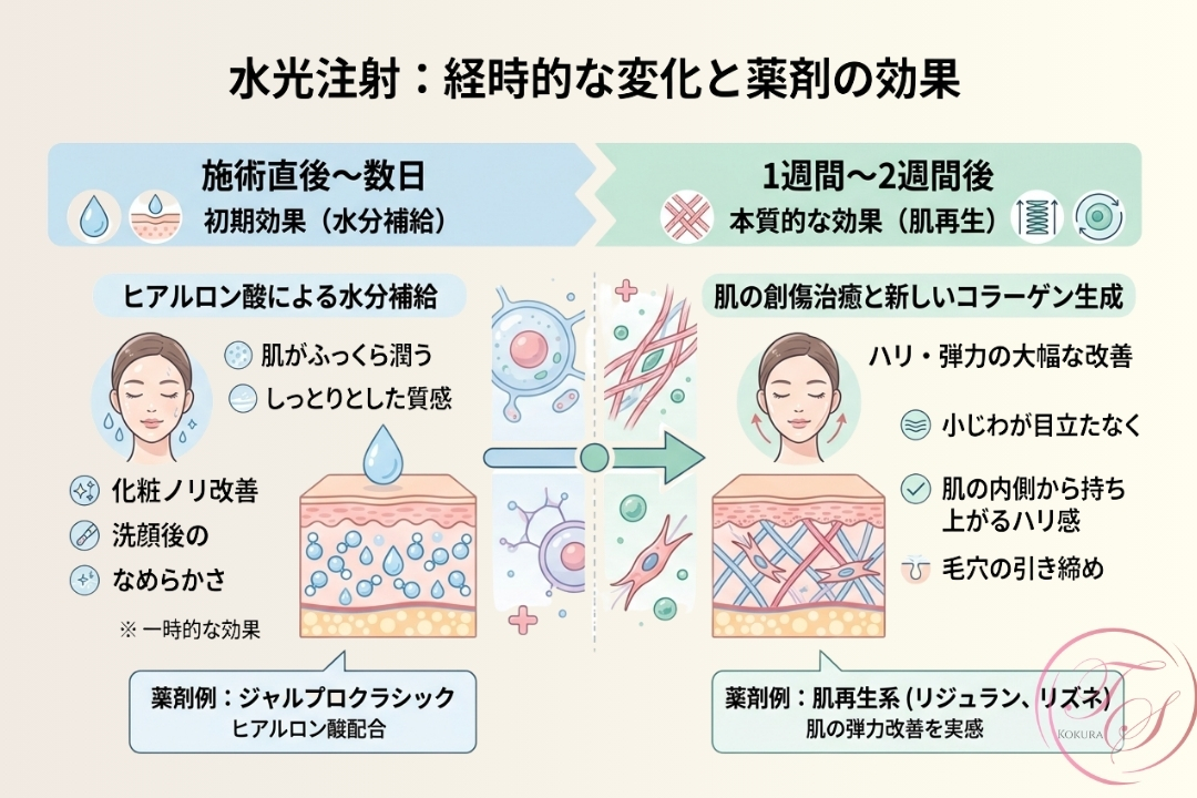 水光注射の施術後から2週間後までの経過と、薬剤ごとの効果の違いを解説した比較図。
左側には、施術直後〜数日の「初期効果（水分補給）」として、ヒアルロン酸（ジャルプロ）による潤いや化粧ノリの改善を記載。
右側には、1〜2週間後の「本質的な効果（肌再生）」として、肌再生系薬剤（リジュラン、リズネ）によるコラーゲン生成、ハリ・弾力の向上、小じわ・毛穴の改善メカニズムを図解しています。（トータルスキンクリニック小倉院）