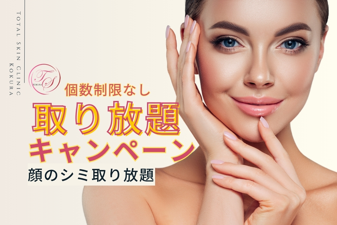 【キャンペーン実施中】顔のシミ取り(個数制限なし)　（トータルスキンクリニック小倉院）