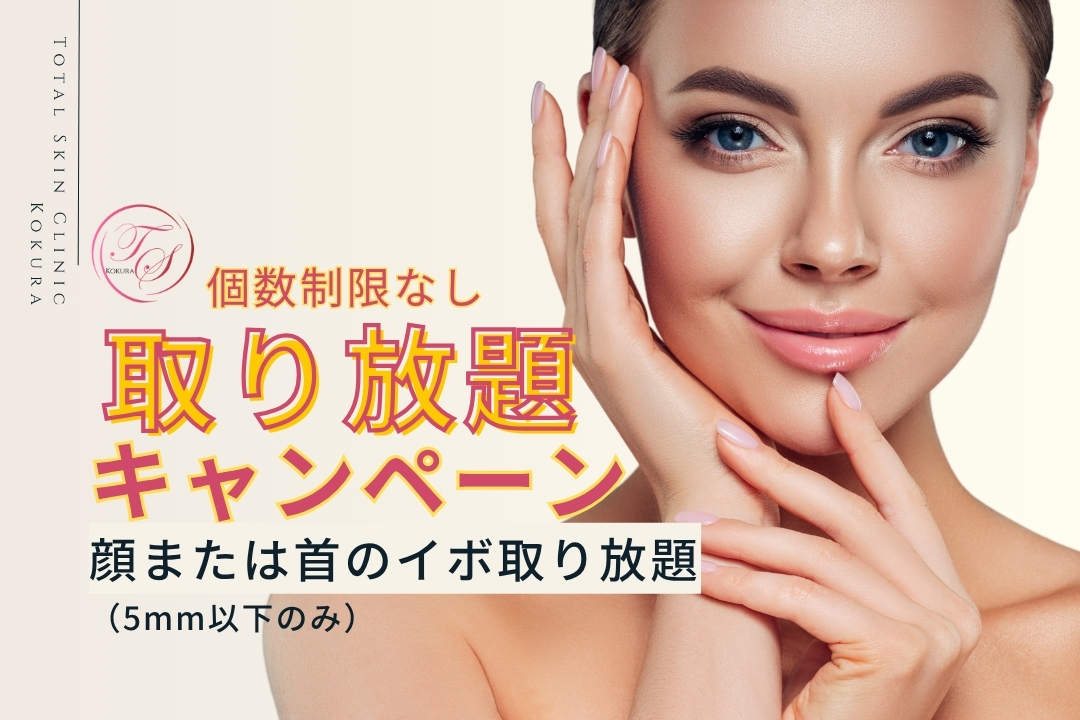 【キャンペーン実施中】顔または首のイボ取り放題（5mm以下のイボのみ）　（トータルスキンクリニック小倉院）
