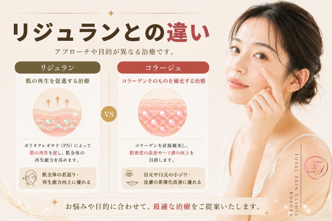 リジュランとコラージュの違いを、PNによる肌再生とコラーゲンの直接補充、顔全体の肌質改善と目元・口元の小ジワ改善の特徴で簡潔に比較した美容医療記事の見出し画像。（トータルスキンクリニック小倉院）