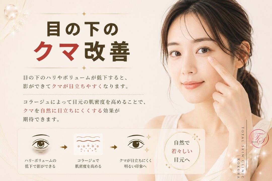 コラージュによって目元の肌密度とハリを高め、目の下の影によるクマを自然に目立ちにくくする効果を表現した美容医療記事の見出し画像。（トータルスキンクリニック小倉院）