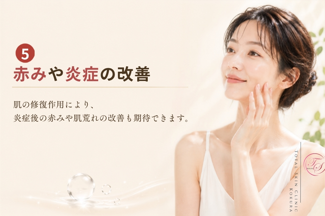 肌の修復作用によって炎症後の赤みや肌荒れの改善を目指すイメージを表現した、トータルスキンクリニック小倉院の画像。