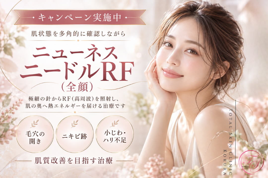 ニューネスニードルRF(全顔)キャンペーンのお知らせ|トータルスキンクリニック小倉